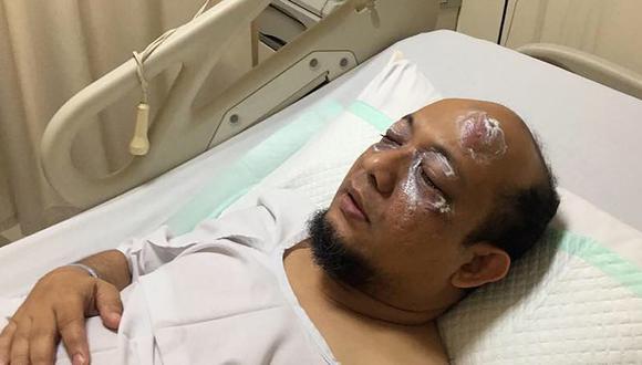 Tras más de un año de convalecencia y múltiples operaciones en Singapur que consiguieron devolverle parte de la vista, el investigador ha retomado sus funciones. (Foto: AFP)