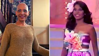 Ex candidata a Miss Venezuela crea fundación para ayudar a mujeres que perdieron su cabello