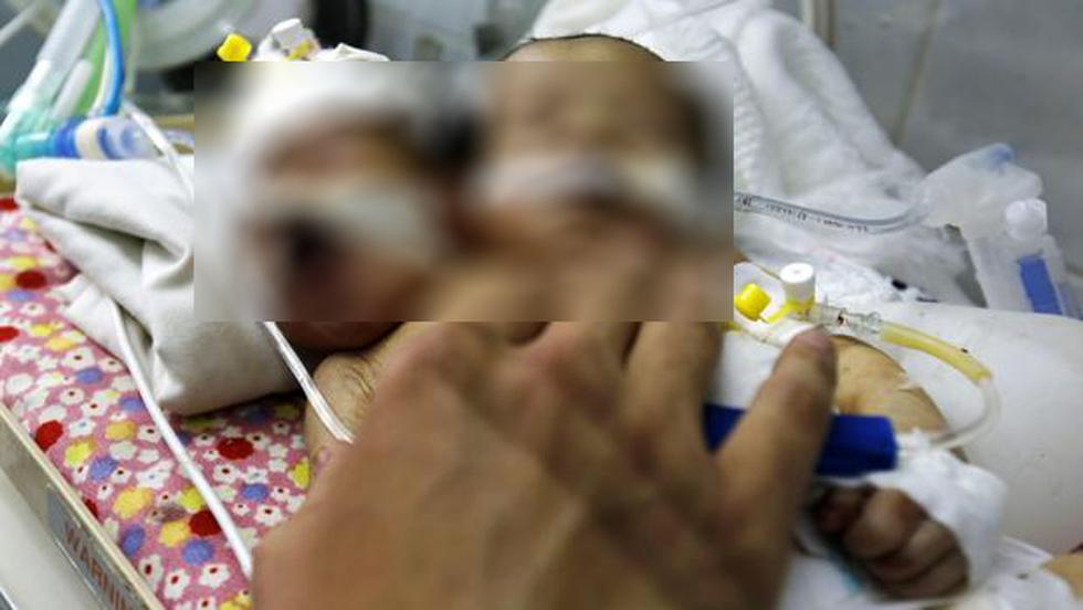 La muerte de unos siameses recién nacidos encrudece aún más la guerra civil en Yemen. (EFE)