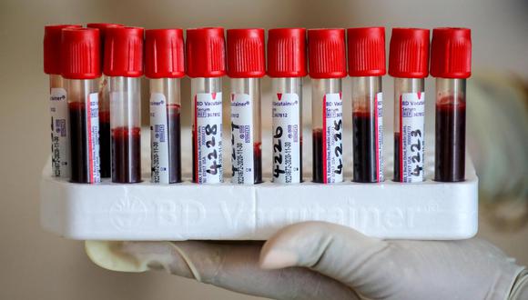 Alzhéimer: Un nuevo test detecta precozmente la enfermedad con un análisis de sangre  (AFP)
