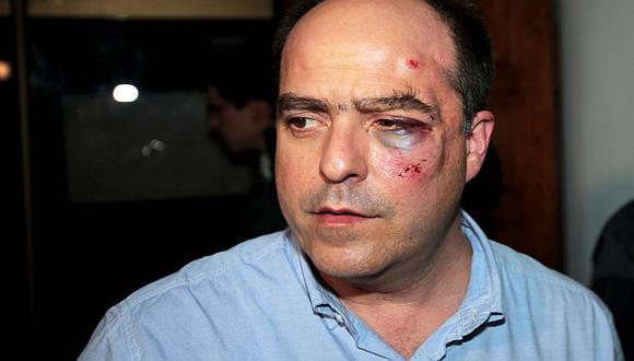 Legislador Julio Borges fue golpeado en el rostro. (AFP)