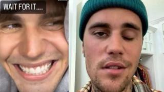 Justin Bieber presume su nueva sonrisa a casi 9 meses de sufrir parálisis facial [VIDEO]