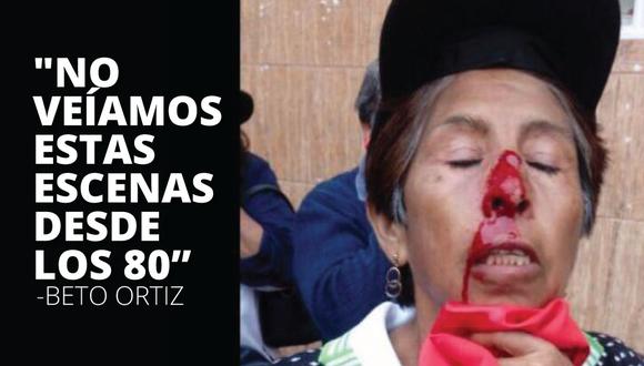 Periodista se preguntó si el ministro Basombrío ordenó disparar perdigones. (Foto: Beto Ortiz)