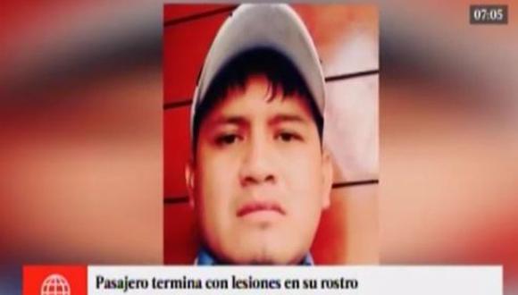Manuel Valencia Huamán es el chófer de la coaster que agredió a pasajero. (América Noticias)