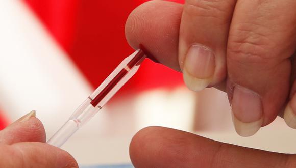Un hombre se somete a una prueba de VIH. (Foto referencial: AFP)