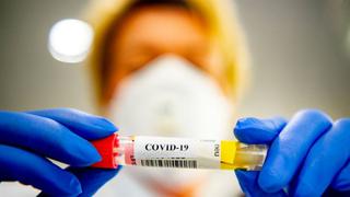 Coronavirus en Perú: La Libertad reporta 81 casos positivos de COVID-19 en un día y cifra de fallecidos asciende a 56 