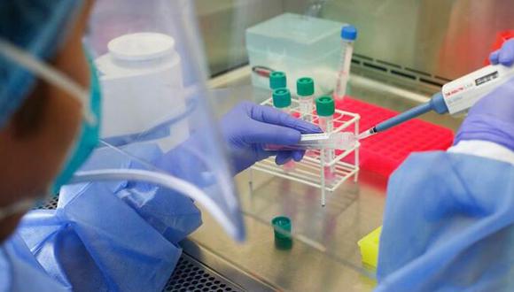 Laboratorio de EsSalud Junín entregará pruebas moleculares COVID-19 en menos de 24 horas