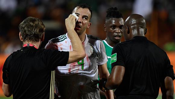 Mira el terrible choque de cabezas en la final de la Copa Africana de Naciones. (Foto: AFP / Video: TMC - Youtube)