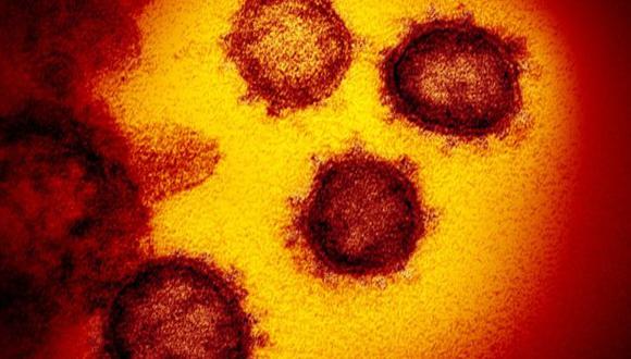 Las protuberancias en el borde exterior de las partículas es lo que le da el nombre al virus, ya que parecen unas coronas. (NIAID-RML)