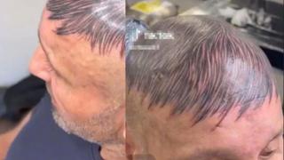 Una idea descabellada: Hombre se tatuó cabello en su cabeza rapada para disimular su calvicie