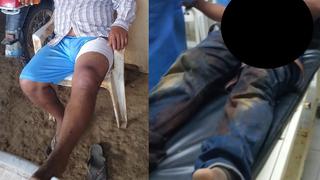 Lambayeque: agricultor es baleado por traficantes cuando retiraba a su ganado