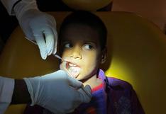 Médicos extrajeron más de 500 dientes de la boca de un niño en la India | FOTOS