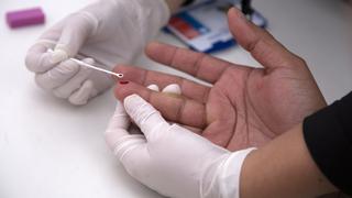 Países Bajos: una nueva variante más contagiosa y agresiva del VIH es descubierta