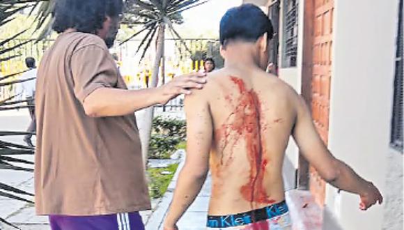 Alumno acuchillado por la espalda durante una pelea en los exteriores de un plantel en el centro de Lima.