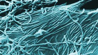 Ébola: 12 puntos claves para entender el virus que recorre África