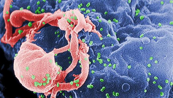 El virus del VIH afecta a unas 33 millones de personas en todo el mundo. (Internet)