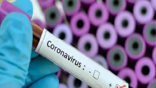 Coronavirus en Perú: Diresa Loreto reporta seis nuevos contagiados y cifra se eleva a 72 por COVID-19