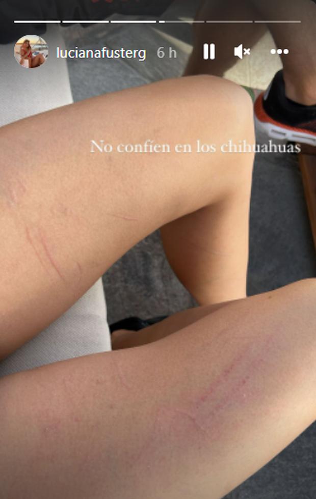 Luciana Fuster fue ‘atacada’ por los perros de Patricio Parodi. (Foto: @lucianafusterg). 