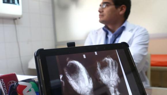 JUEGO FATAL. Radiografía muestra los daños que sufrió el menor. (Rafael Cornejo)