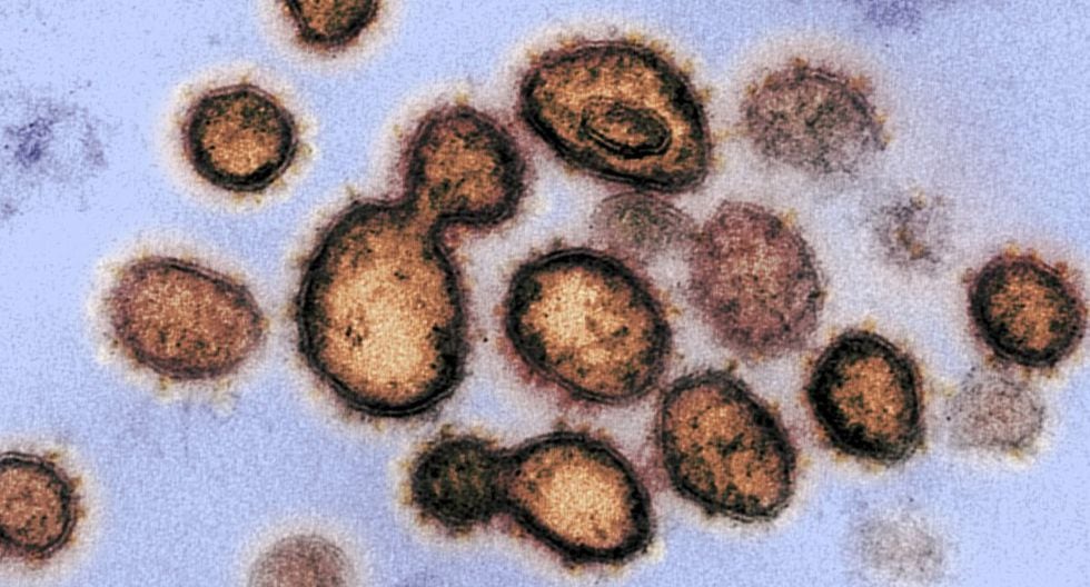 Vistazo microscópico del SARS-CoV-2, el virus causante del covid-19, aislado de un paciente estadounidense (Foto: AFP)