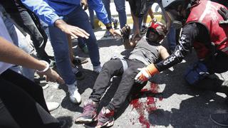 Segundo día de 'Operación Libertad': Un muerto y más de cien heridos deja la movilización en Venezuela