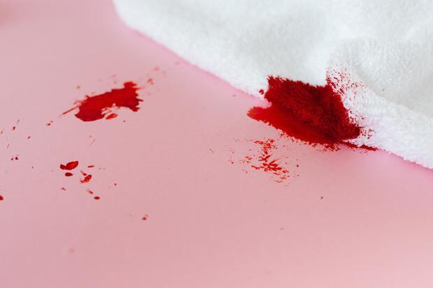 Remedios caseros quitar las manchas de sangre de las prendas | Trucos | Hacks | nnda | VIDA | PERU21