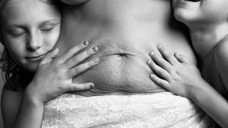 FOTOS: "Un cuerpo bello", proyecto que retrata madres sin Photoshop