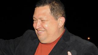 “Chávez está en buena condición”