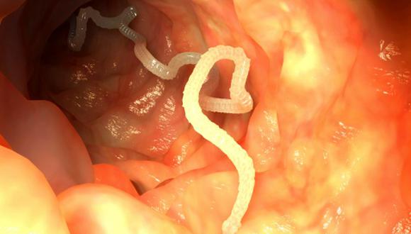 Artwork of an intestinal tapeworm.