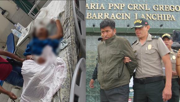 Mujer maltratada revela que expareja le dijo que la iba a matar mientras la golpeaba en Tacna. (GEC)