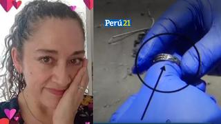 Policía indica que anillo hallado en cuerpo cercenado “concuerda” con el de mexicana desparecida
