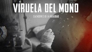 Viruela del mono en el Perú: conoce el caso de un paciente que contrajo esta enfermedad