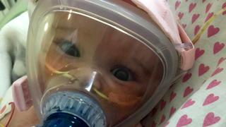 Coronavirus: bebe de seis meses lucha por su vida conectada a una máquina de oxígeno