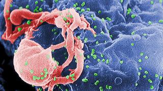 El avance en la lucha contra el sida es el logro científico del año