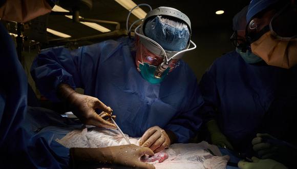Un equipo médico de EE. UU. Ha logrado unir temporalmente el riñón de un cerdo a una persona, un avance en el trasplante aclamado como un "milagro potencial" por el cirujano que dirigió el procedimiento. (Foto de Joe Carrotta / NYU Langone Health / AFP)