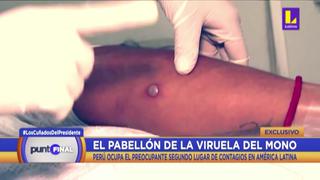 Hospital Cayetano Heredia: Conoce cómo es el pabellón que trata a infectados con la viruela del mono
