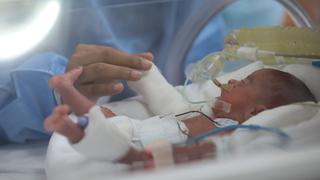 Más de un millón de bebés prematuros mueren cada año en el mundo