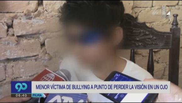Piura: Niño víctima de bullying a punto de perder la visión en un ojo por agresión. (Captura)