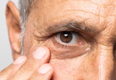 Glaucoma: Conoce cómo detectarlo y tratarlo a tiempo