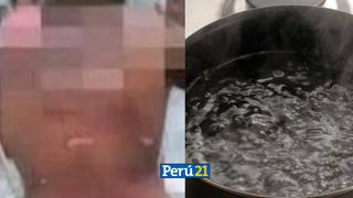 Mujer quema a su yerno con agua hirviendo porque “iba siempre a almorzar sin que lo inviten”