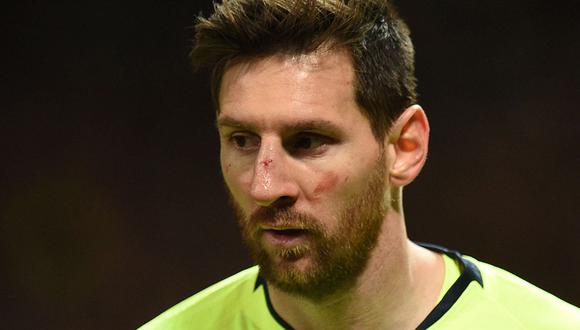 Lionel Messi se someterá a exámenes médicos para descartar una lesión de gravedad en la nariz. (Foto: AFP)