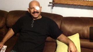 Oscar D'León podría recuperar la visión del ojo izquierdo