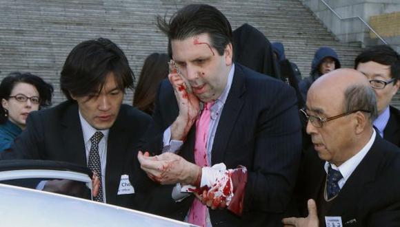 Embajador de EEUU en Seúl, Mark Lippert, fue acuchillado por un activista radical surcoreano. (Reuters)