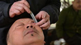 China: limpian ojos afeitando el globo ocular