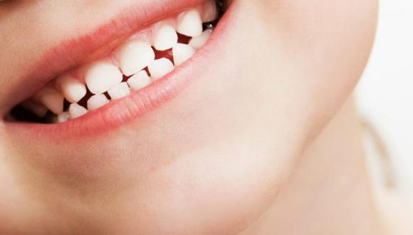 Los sellantes dentales son cubiertas plásticas que son colocadas en la cara de la mordida (oclusal) de los dientes.