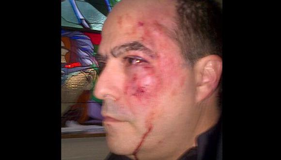 INTOLERANCIA. Legislador Julio Borges fue golpeado en el rostro. (AFP)