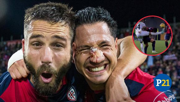 Lapadula recibió una patada en el rostro, pero inició la remontada del Cagliari con un golazo