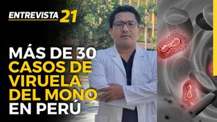 Infectólogo Juan Celis: Se reportan más de 30 casos de viruela del mono