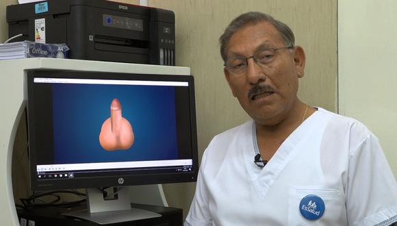 ¡Como nuevo! Médicos peruanos reconstruyen el pene de hombre de 60 años con éxito. (EsSalud)