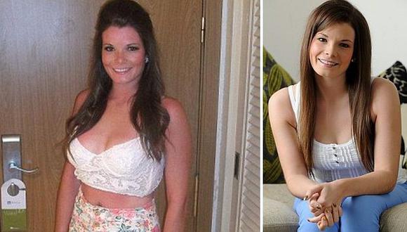 Fiona antes (izq.) y después (der.) de someterse a la doble mastectomía. (Daily Mail)